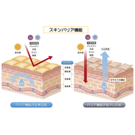 高機能還元性イオン水により自己細胞由来のセラミド合成の促進を確認