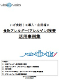 ＼無料プレゼント！／≪ いざ実践！ 導入・応用編≫ 食物アレルギー（アレルゲン） 検査 活用事例集
