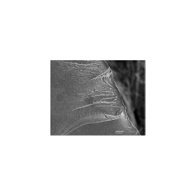 急速破壊(リバーパターン)