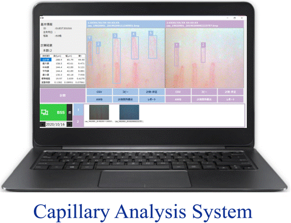 毛細血管スコープ(血流スコープ)画像解析ソフト