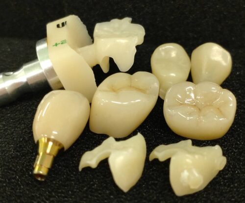 歯科技工サービス