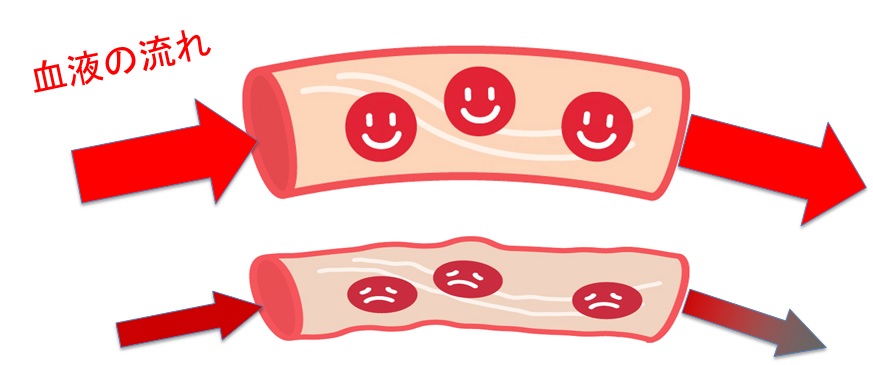 LBSカルチャーと口腔内炎症改善作用と歯茎・粘膜の血流上昇作用
