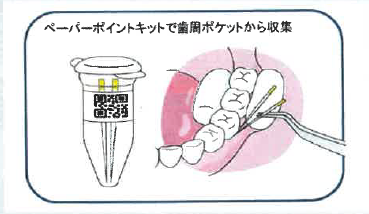 口腔内細菌叢解析『歯周病疾患検査サ  ービス』