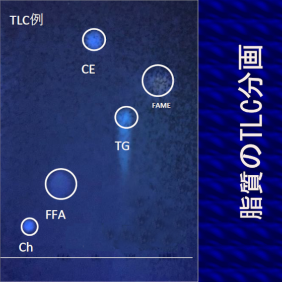 脂質TLC.png