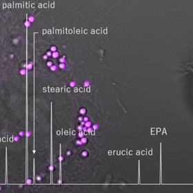 脂肪酸の定量分析(GC/MSによる)