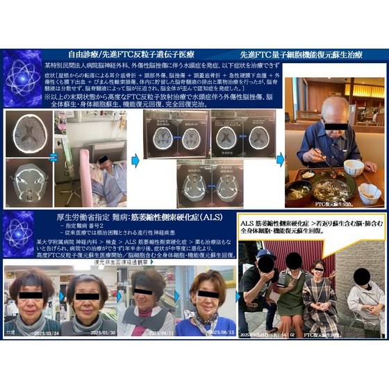 （FTCパンフ）S・K0260716FTC 回復蘇生治療.FTC製品Btob,btog「Pポイント」.jpg