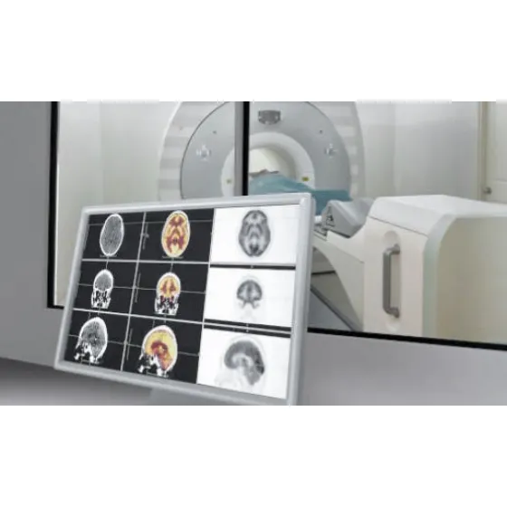 thermal-control-of-MRI-systems-520-325.jpg
