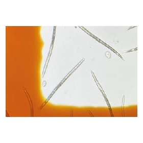 Nematode-related tests