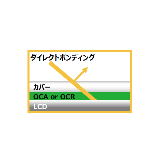 ダイレクトボンディング.png