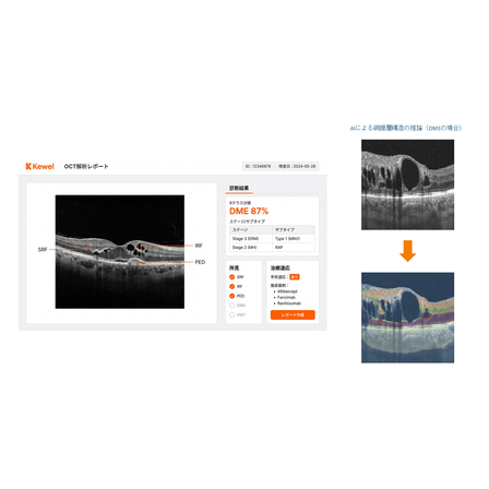 Kewel_slides_external_oct.png
