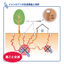Termite control
