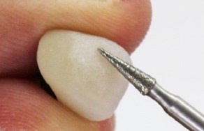 セラミック専用ダイヤモンド電着ポイントのご提案