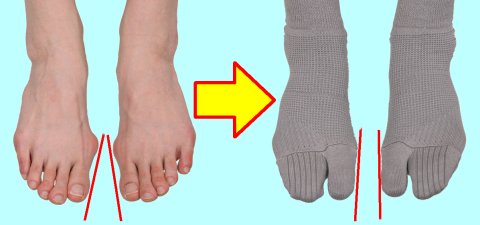 『外反母趾対策くつ下』