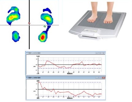 フットプリンター 足形計測 足圧 測定 足圧分布測定システム『フット