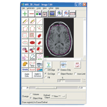 ソフト　バイオメディカルイメージ可視化分析ソフト　Analyze