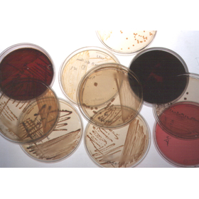 BacteriaColony03.jpg