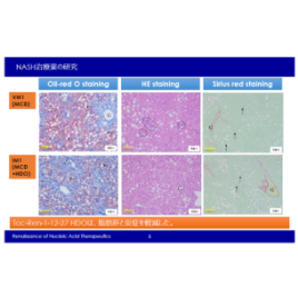 医薬品パイプライン NASH治療薬(核酸医薬)