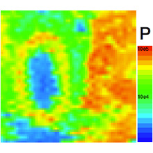 LA-ICP-MSによる生体試料のマッピング分析