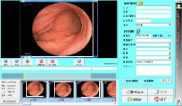 動画toDICOM変換ソフトウェア『LamVideoToDcm』
