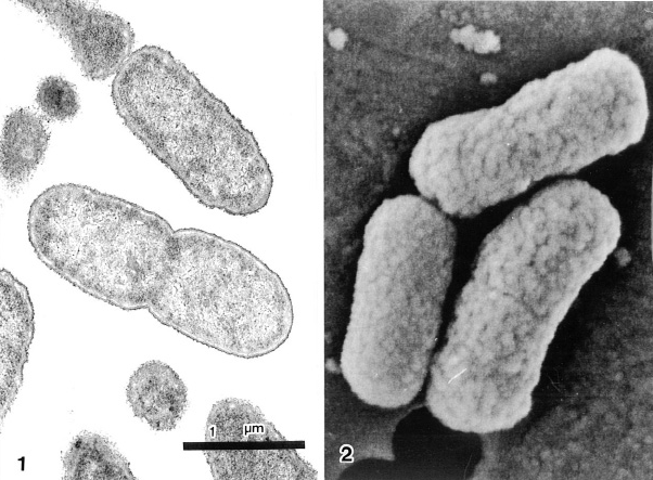 【解析事例】病原性大腸菌O-157