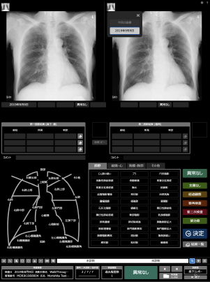胸部・胃部健診ビューワ