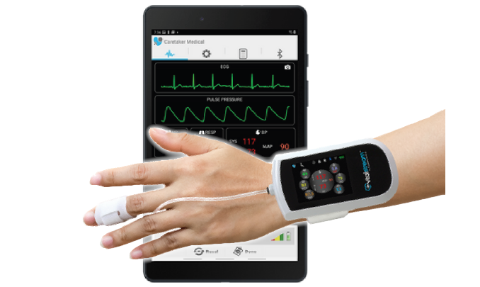 【非観血連続血圧監視装置】VitalStream