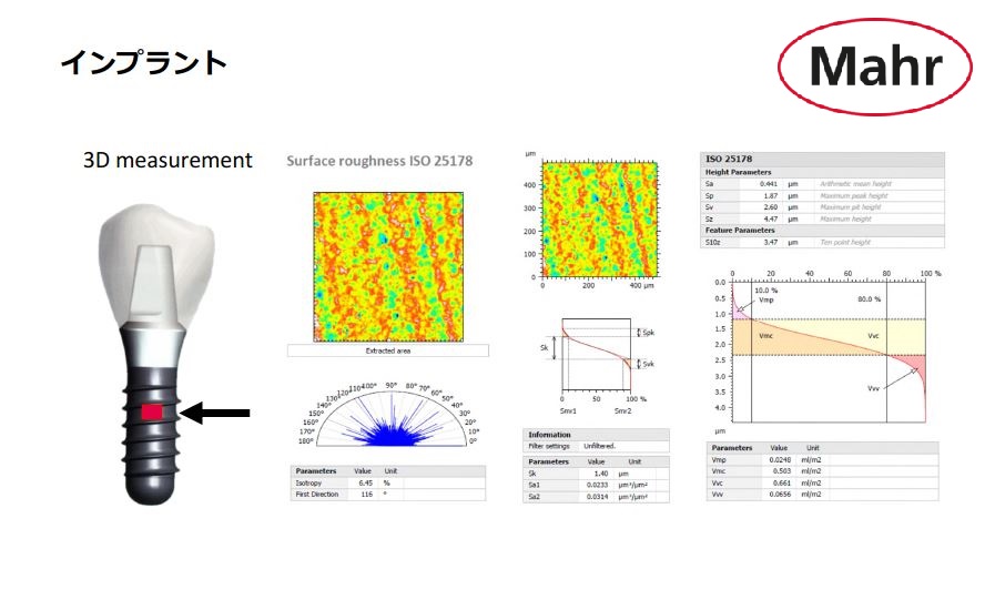 【測定事例：医療用高精密部品編】『MarSurf CP/CL』