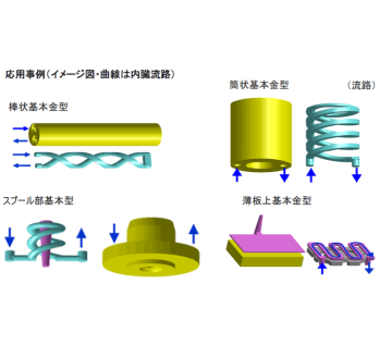 ダイレクトボンディング