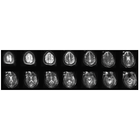 Bluestone_imaging2.png