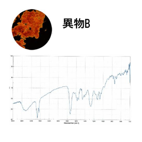 異物B.png